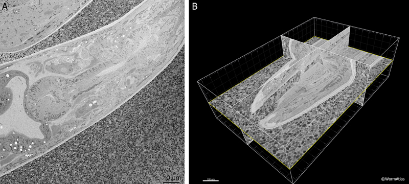 EMSerialblockFIG 1: Three-dimensional imaging from a Denkotome.